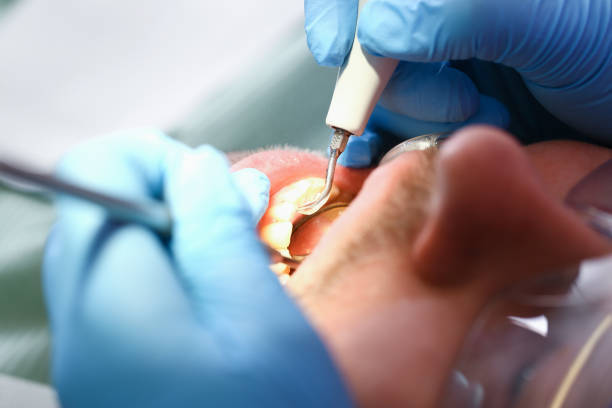 Best Dental Abscess Treatment in Lake Of The Woods, AZ