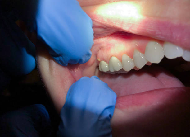Best Emergency Dental Care for Sports Injuries in Lake Of The Woods, AZ